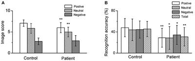 Somatization Symptoms Regulate Emotional Memory Bias in Adolescents With Major Depressive Disorder